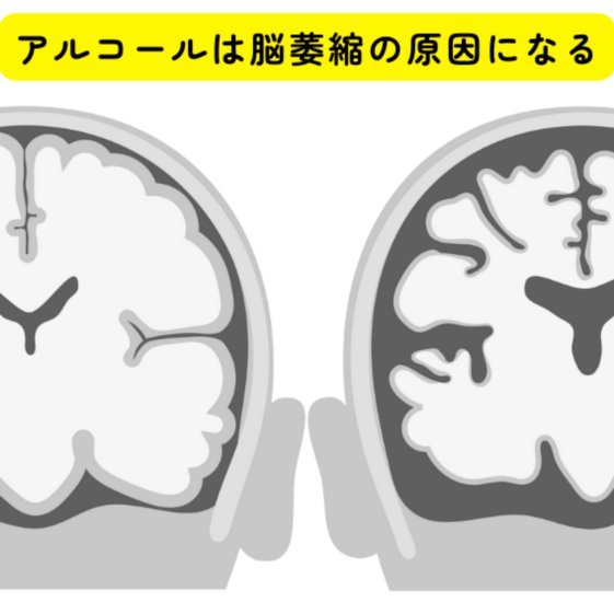 鹿优选商城提现攻略全解析